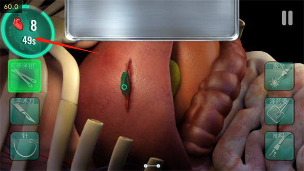 医院手术时间中文版
