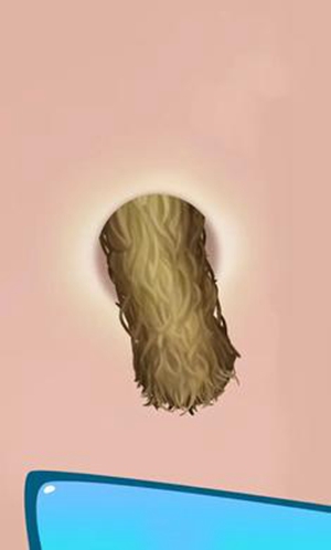 挤痘痘达人官方正版