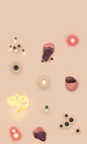 挤痘痘达人官方正版